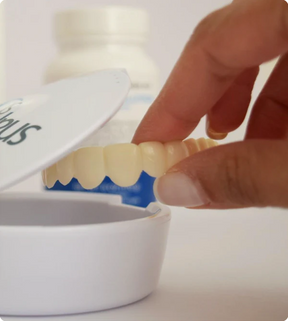 SOURIRE PARFAIT - FACETTES DENTAIRES INFÉRIEURES ET SUPÉRIEURES